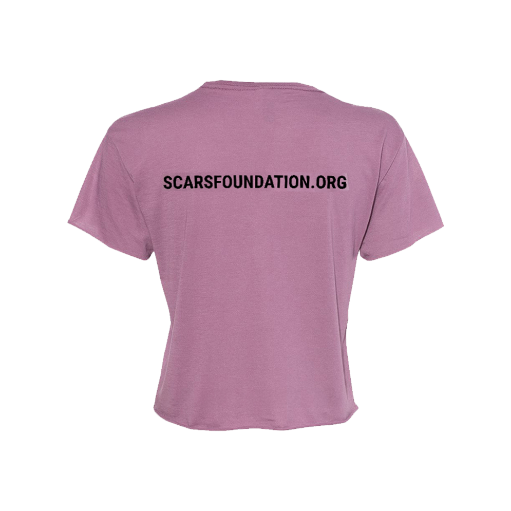 Scars Circle Logo Crop Tee