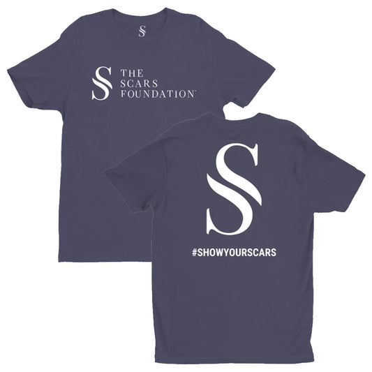 Blue Show Your Scars Tee